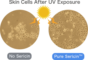 Skin Cells After UV Exposure