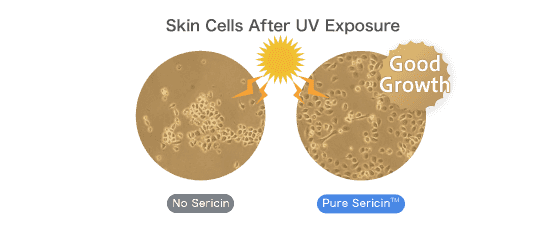 Skin Cells After UV Exposure