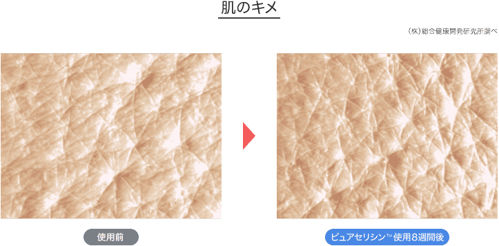 ピュアセリシンTM使用8週間後