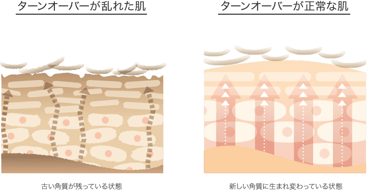 ターンオーバーが正常な状態